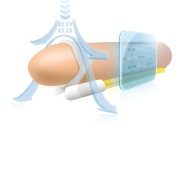 Andropenis Mini Penis Extender